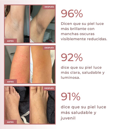 Spray exfoliante corporal - Kójico + Cúrcuma
